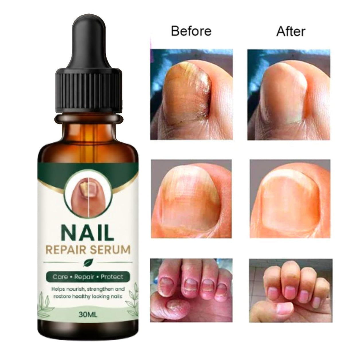 Nail Growth And Repair Serum (Pack of 1)