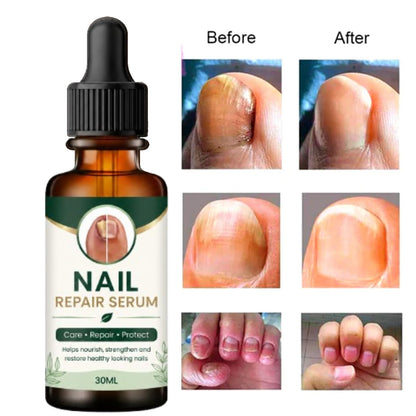 Nail Growth And Repair Serum (Pack of 1)
