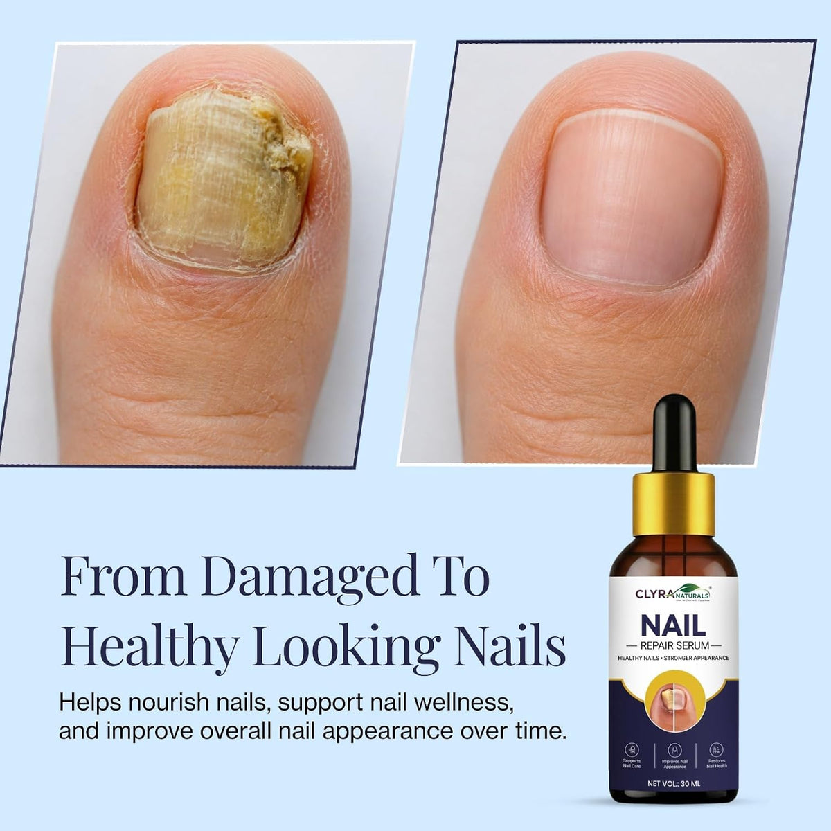 Nail Growth And Repair Serum (Pack of 1)