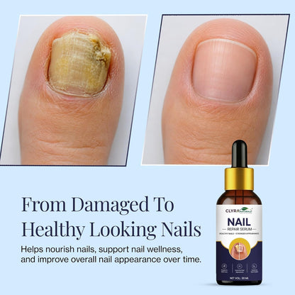 Nail Growth And Repair Serum (Pack of 1)