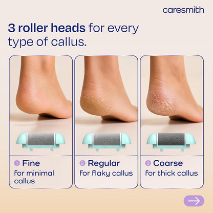 Electric Callus Remover