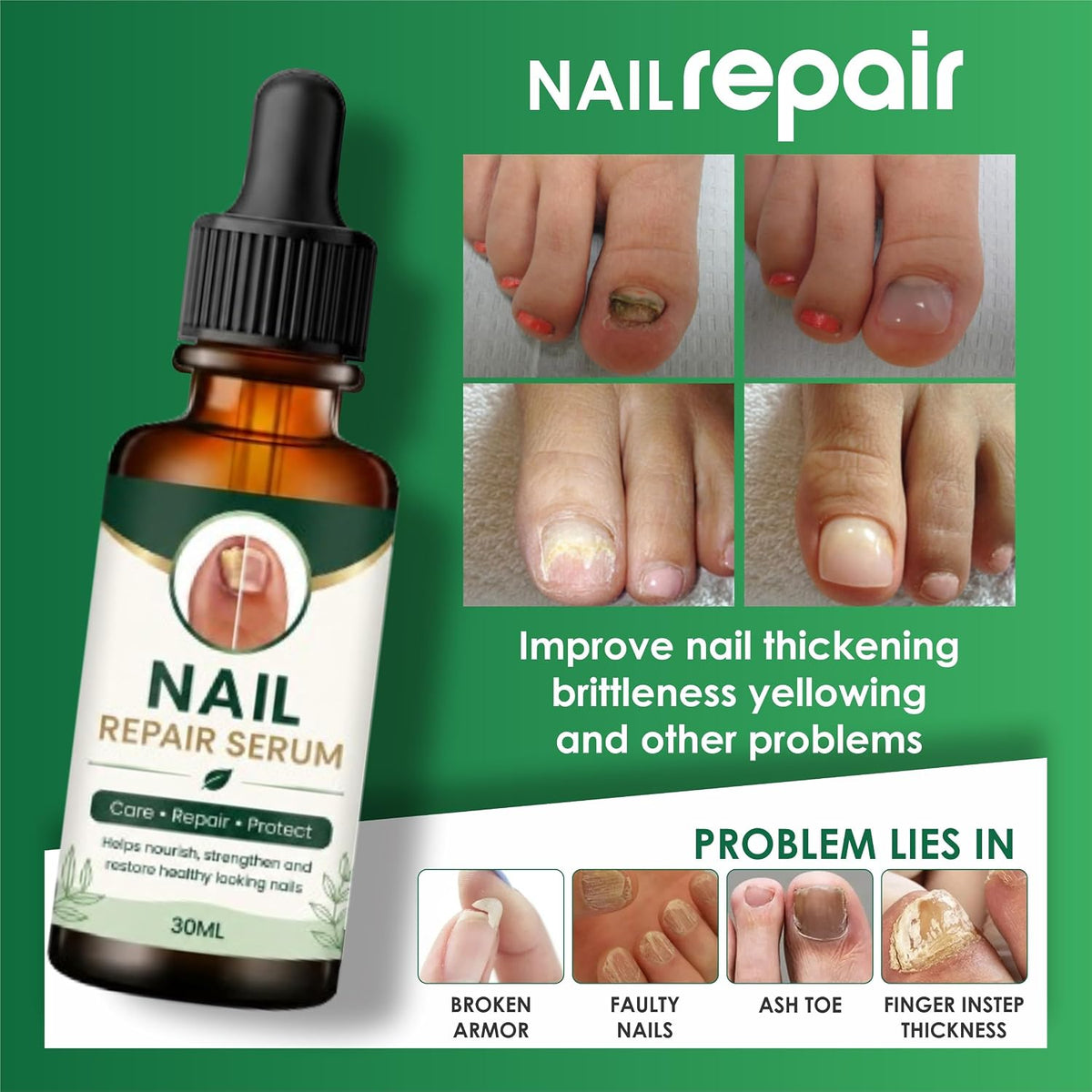 Nail Growth And Repair Serum (Pack of 1)