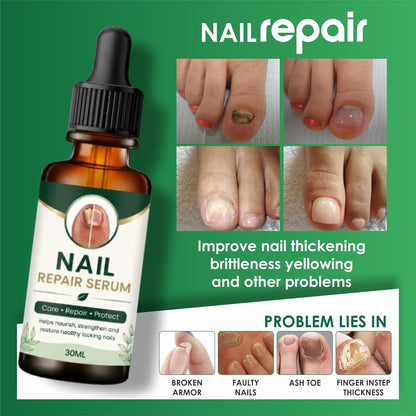 Nail Growth And Repair Serum (Pack of 1)