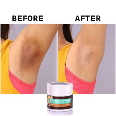 Coffee Face And Body Instant Dead Skin Remover