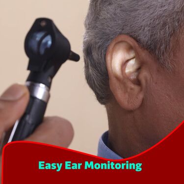 Otoscope Pen lens with Acrylic lens (ECL)