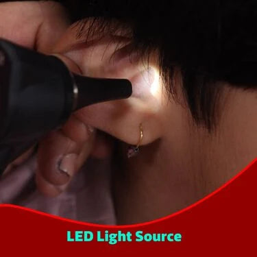 Otoscope Pen lens with Acrylic lens (ECL)