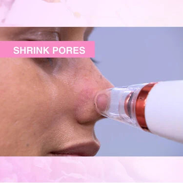 Instant Blackhead Remover Vacuum Suction Device (BVD)