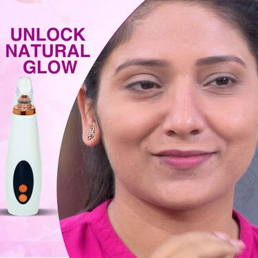 Instant Blackhead Remover Vacuum Suction Device (BVD)